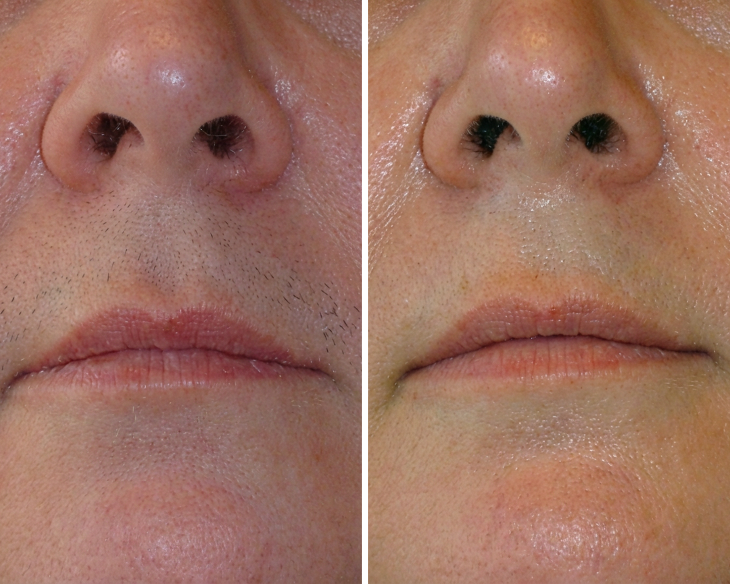 Lumea Skin Cyperus Rotundus Serum