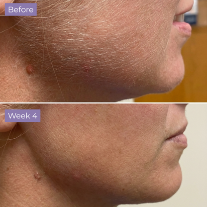 Lumea Skin Cyperus Rotundus Serum