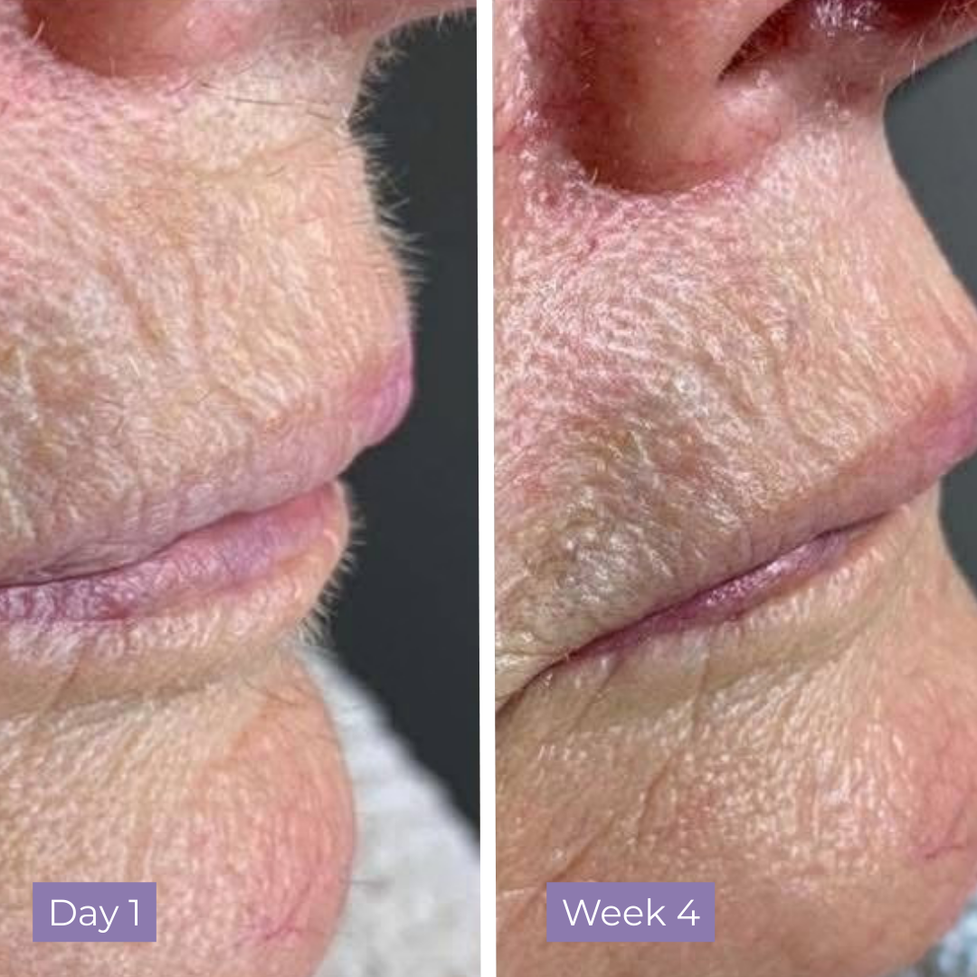 Lumea Skin Cyperus Rotundus Serum