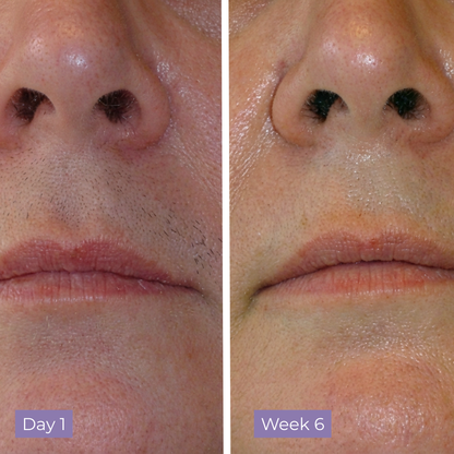 Lumea Skin Cyperus Rotundus Serum