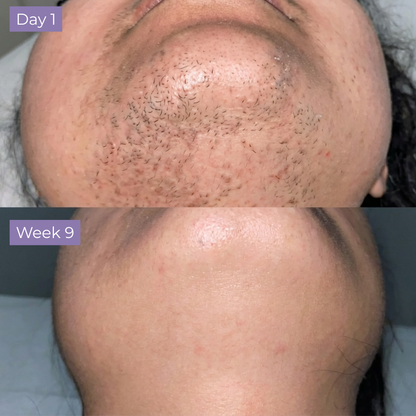 Lumea Skin Cyperus Rotundus Serum