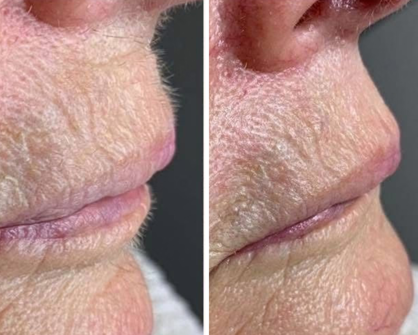 Lumea Skin Cyperus Rotundus Serum