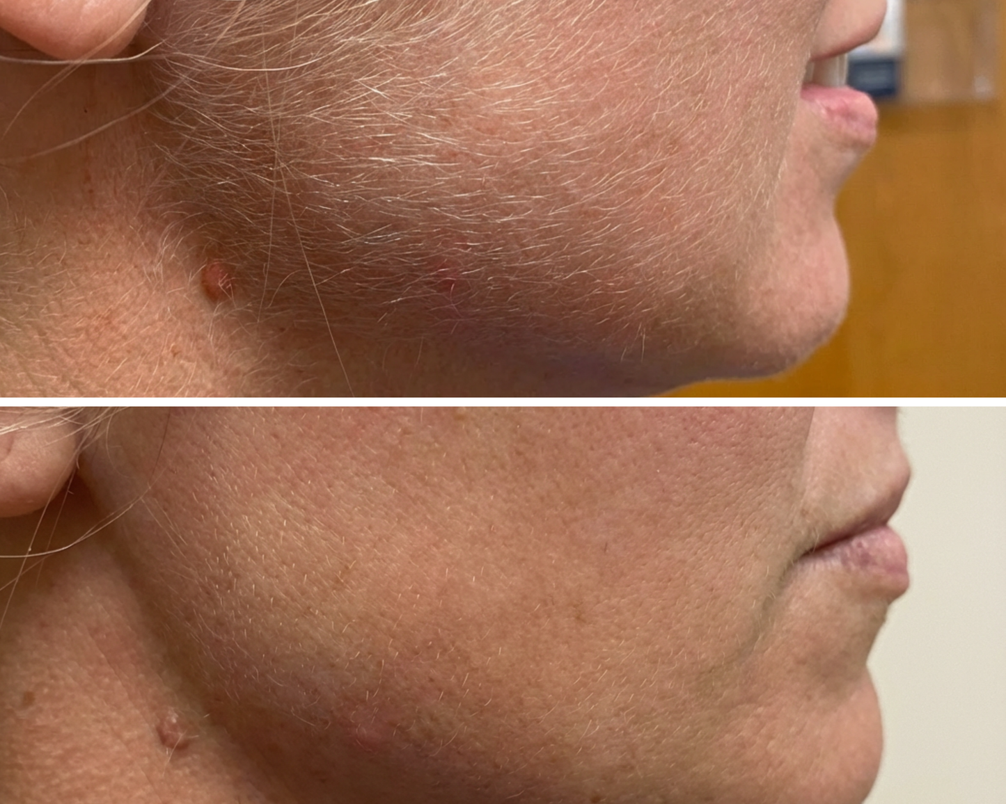 Lumea Skin Cyperus Rotundus Serum
